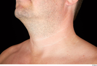 Paul Mc Caul neck 0003.jpg